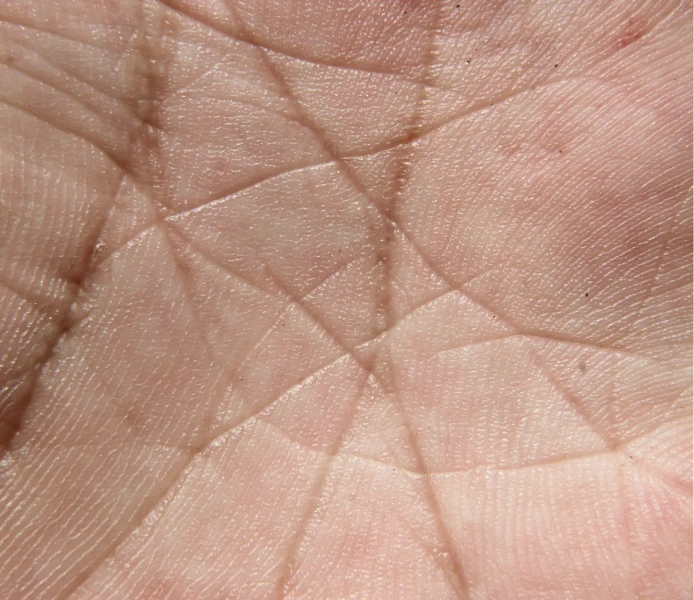 Pele